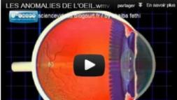 Les principales anomalies de l'oeil