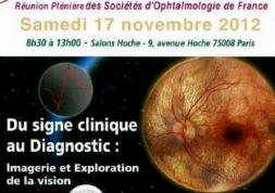 Congrès 2012 des Sociétés d’Ophtalmologie: Le programme 