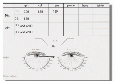 L’ordonnance des lentilles de contact valable 5 ans ?