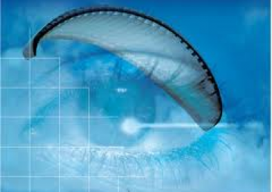 Une nouvelle lentille pour kératocône en silicone hydrogel !