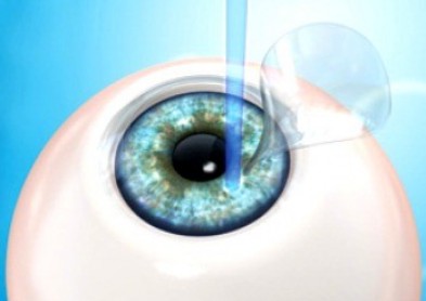 Sondage: opération au Lasik ou lentilles de contact ?