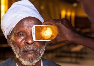 Peek, le smartphone pour dépister les maladies des yeux